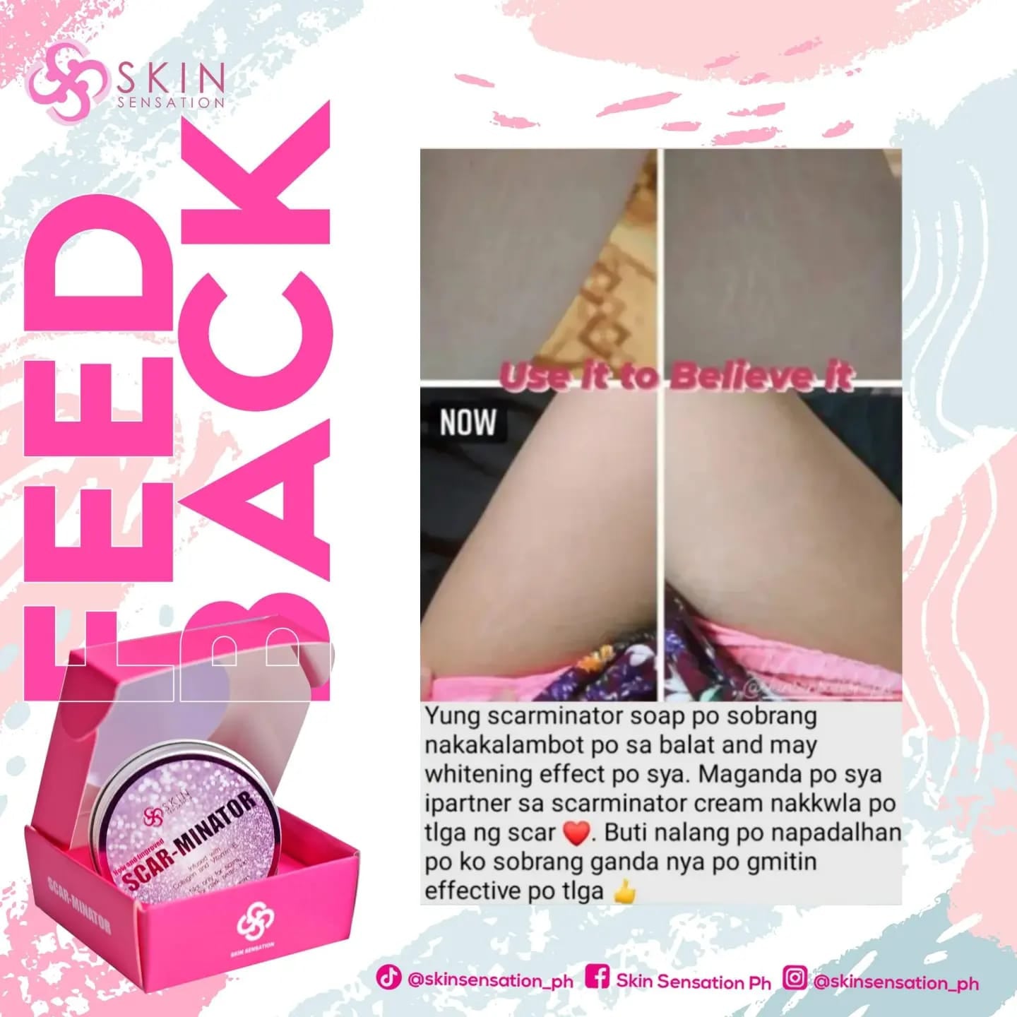 SCARMINATOR CREAM BY SKIN SENSATION