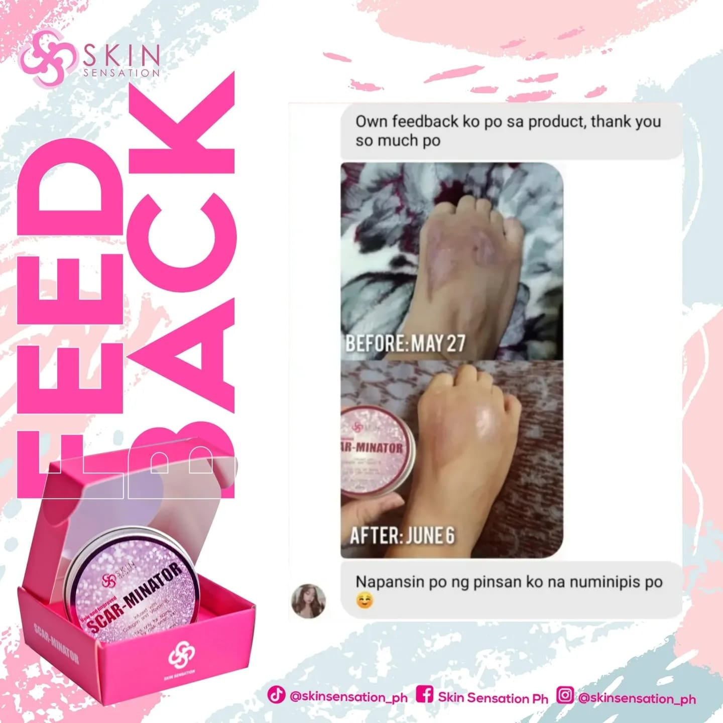 SCARMINATOR CREAM BY SKIN SENSATION