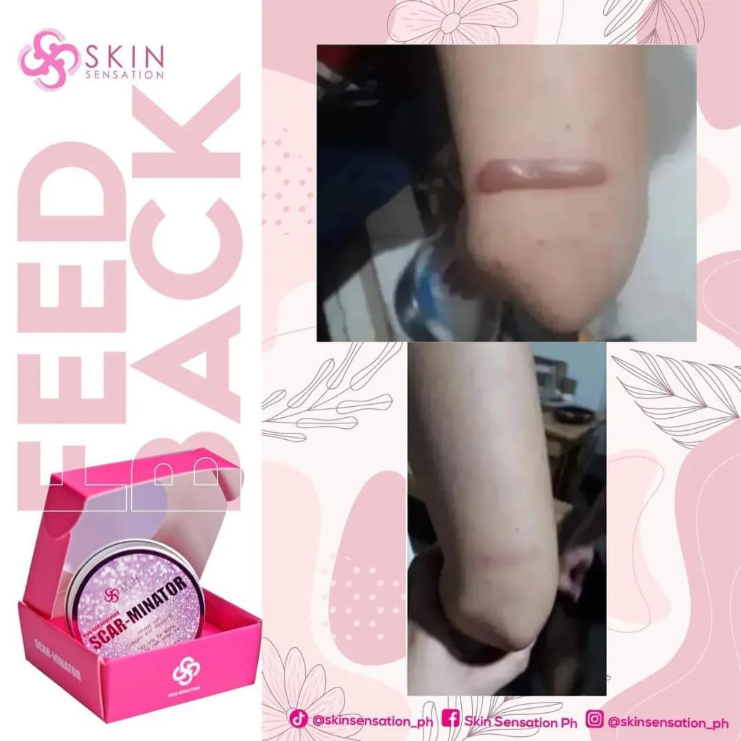 SCARMINATOR CREAM BY SKIN SENSATION