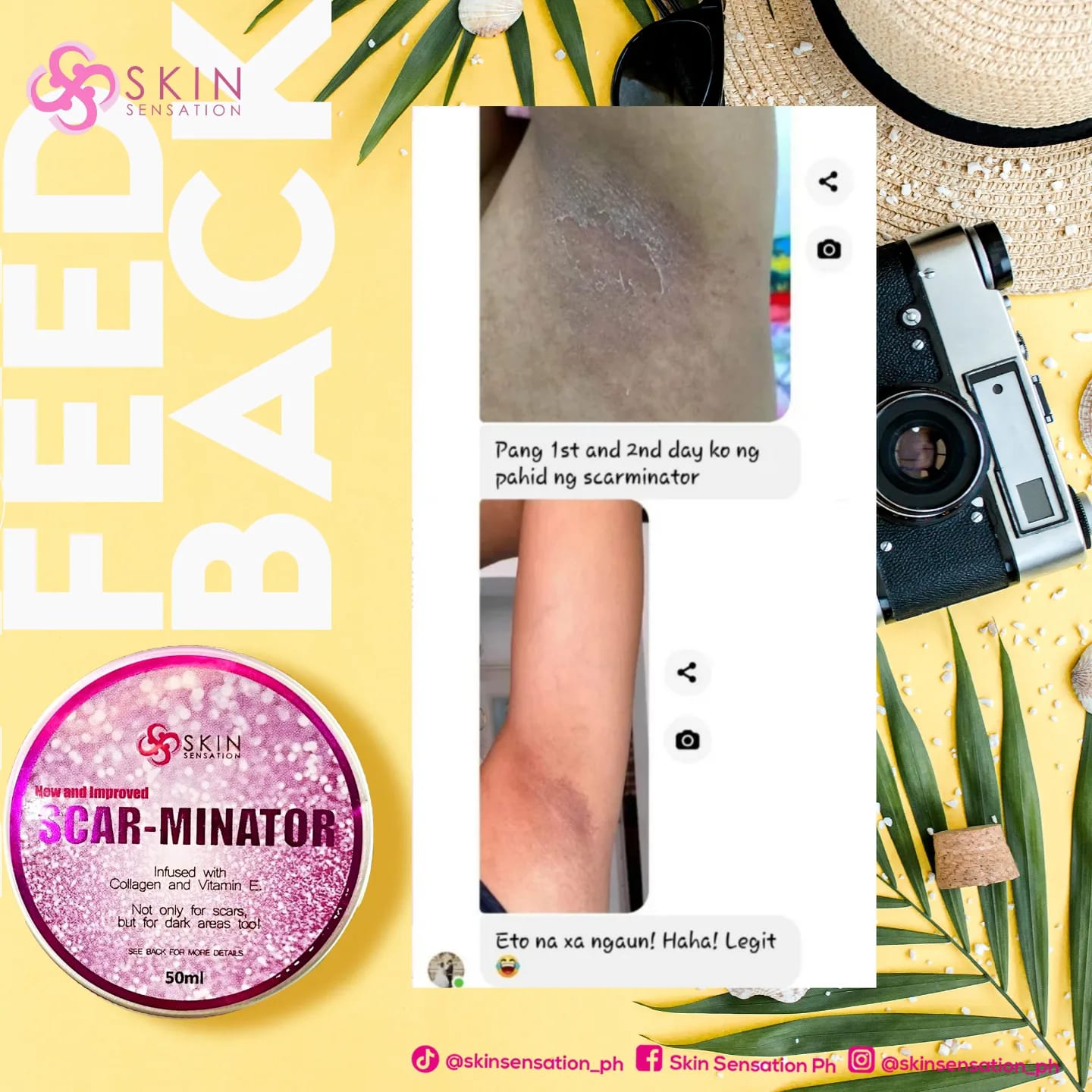 SCARMINATOR CREAM BY SKIN SENSATION