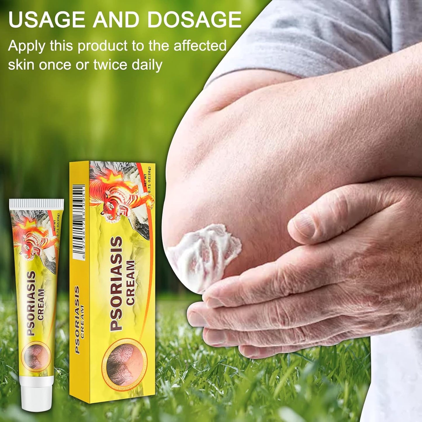 PSORIASIS CREAM 20g