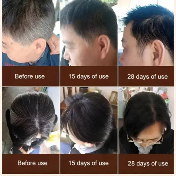 GINSENG GANODERMA HERBAL SHAMPOO FOR GROWTH SHINY AND HEALTHY HAIR 300ml