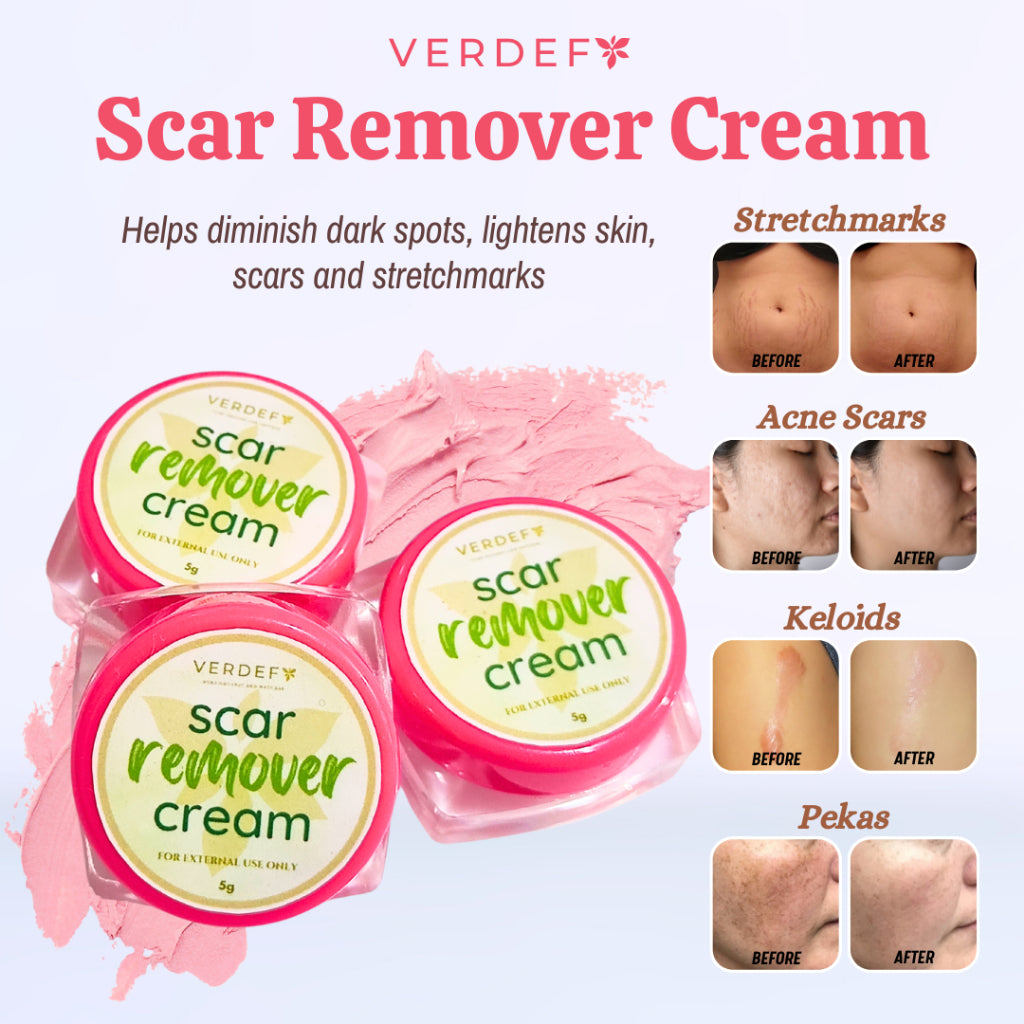 VERDEFY Scar Remover Cream