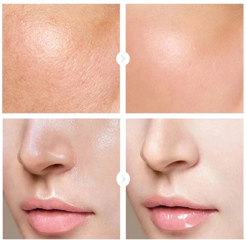 Thailand's Niacinamide Serum 10% 30ml