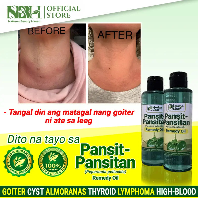 Pansit Pansitan Remedy Oil