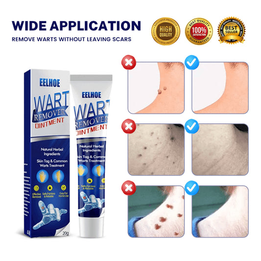 Wart Remover Ointment 20g