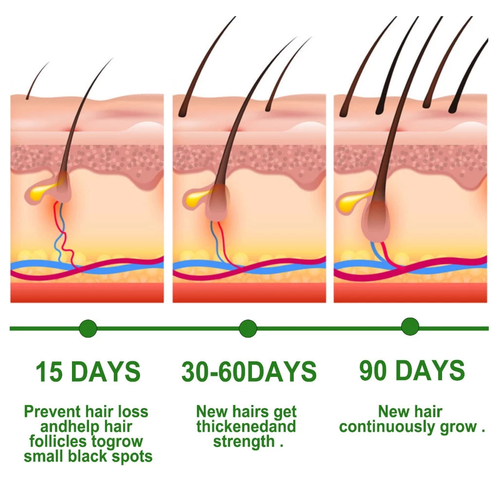 EELHOE Rosemary Hair Growth Essential Oil