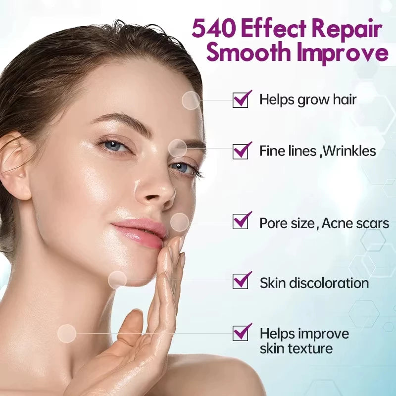 540 Titanium Microneedle Scar Derma Roller