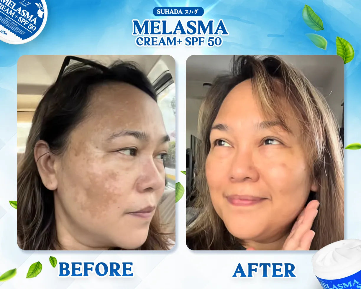 Suhada Japanese Melasma Cream with SPF50