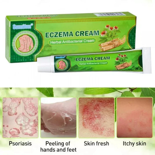 ECZEMA CREAM Herbal Antibacterial Cream 20g