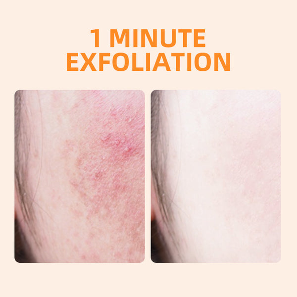 GMEELAN ORANGE EXFOLIATING GEL AND LAZY CREAM