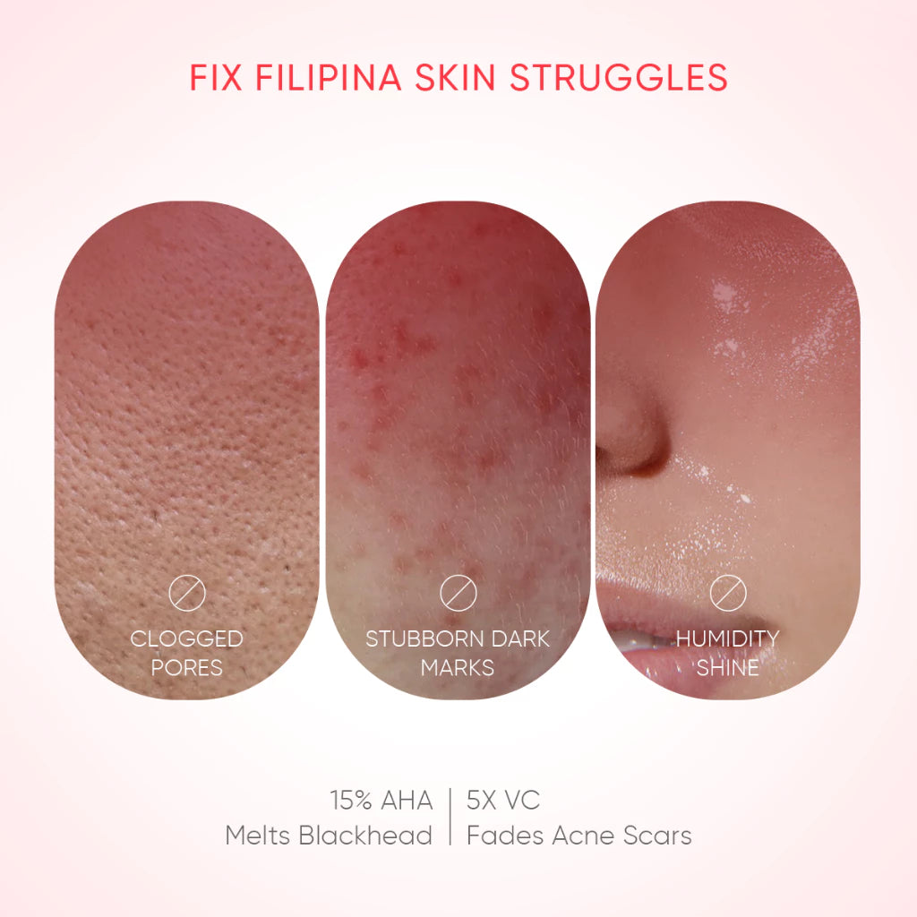 GMEELAN Centella AHA Peeling Serum 5X vC Brightening Exfoliating Even Skin Tone Facial Serum