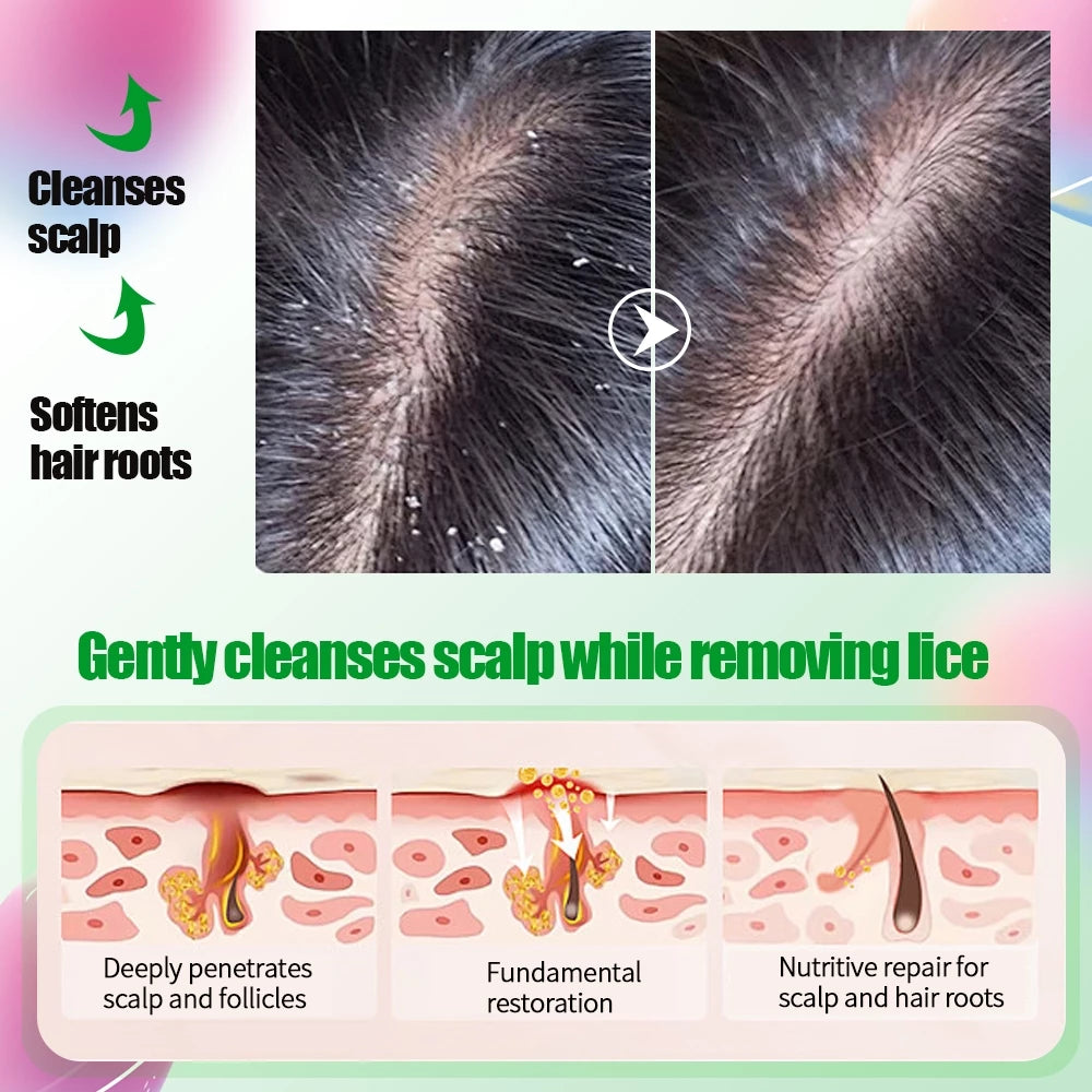 TEN TWENTY Head Lice Defense Shampoo 300ml