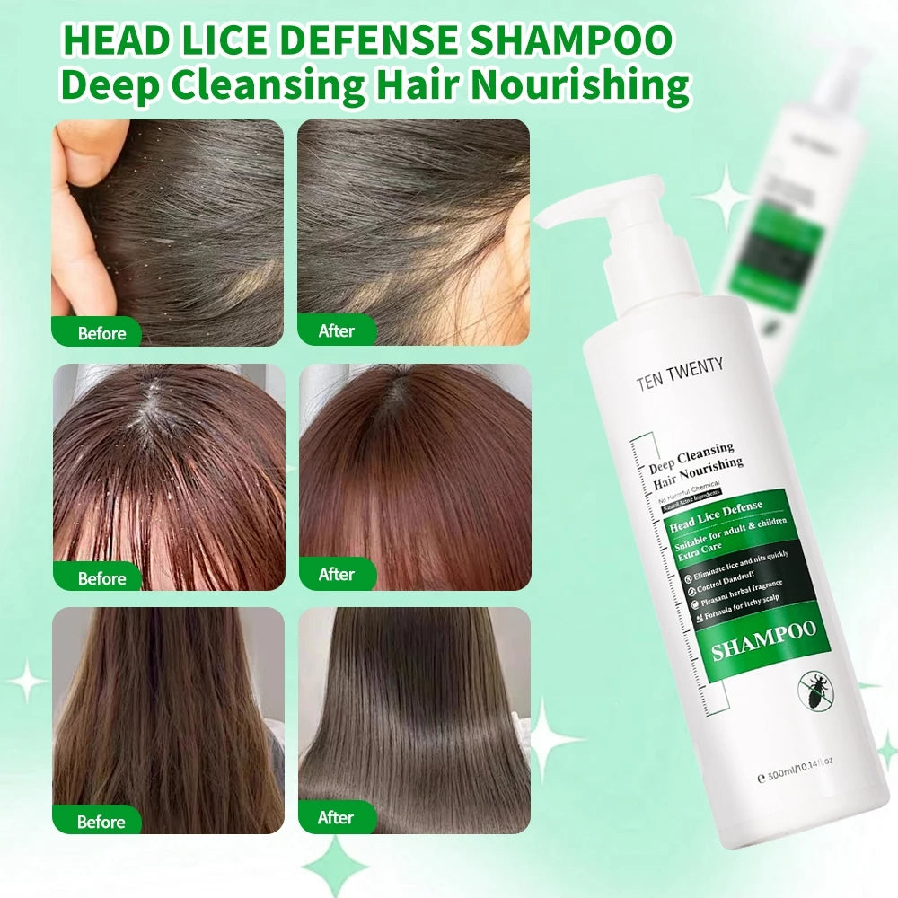 TEN TWENTY Head Lice Defense Shampoo 300ml