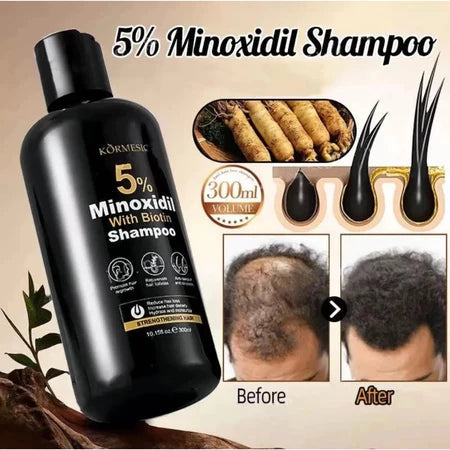 KORMESIC 5% Minoxidil with Biotin Shampoo 300ml