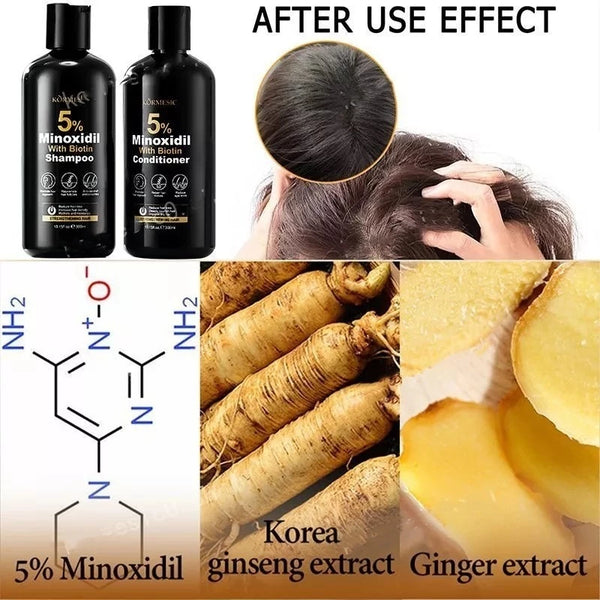 KORMESIC 5% Minoxidil with Biotin Shampoo 300ml