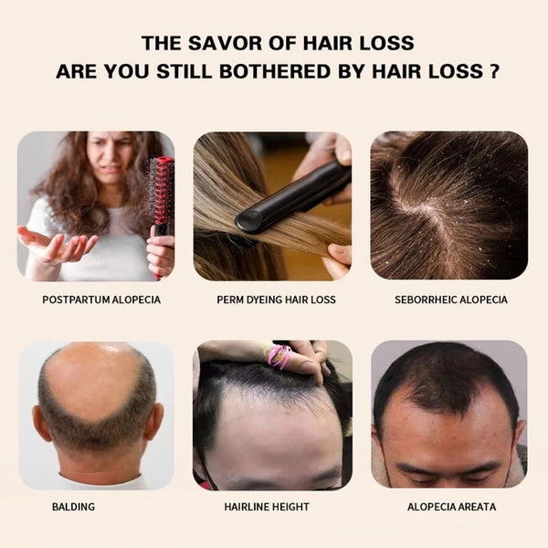 KORMESIC 5% Minoxidil with Biotin Shampoo 300ml