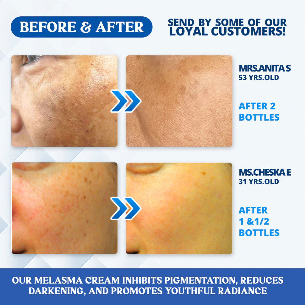 Suhada Japanese Melasma Cream with SPF50