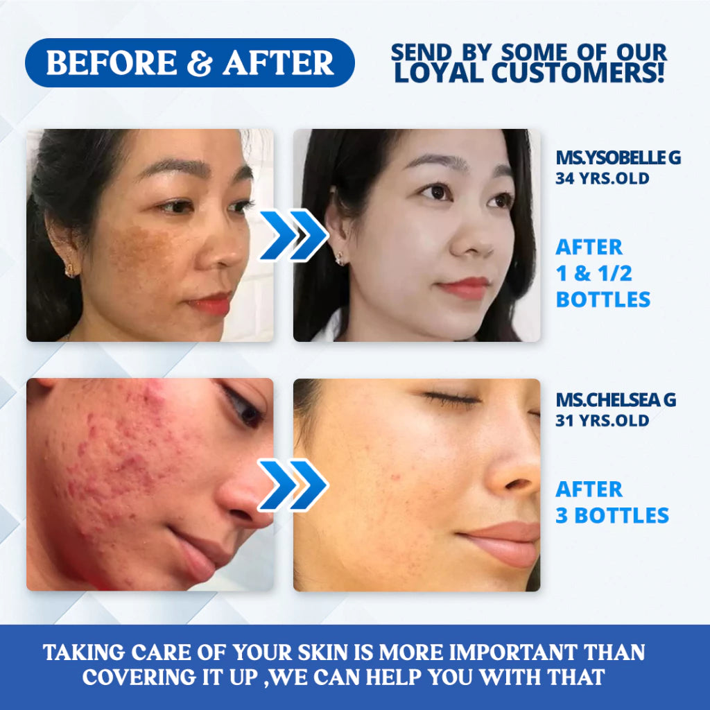 Suhada Japanese Melasma Cream with SPF50