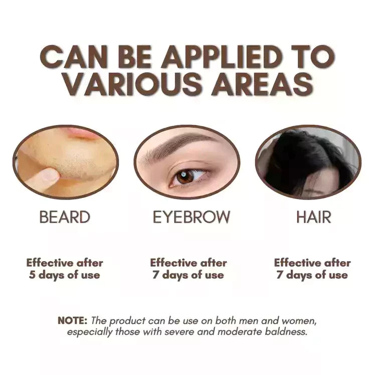 HOSOKU 15% Minoxidil Hair Growth Serum (Oil Based)