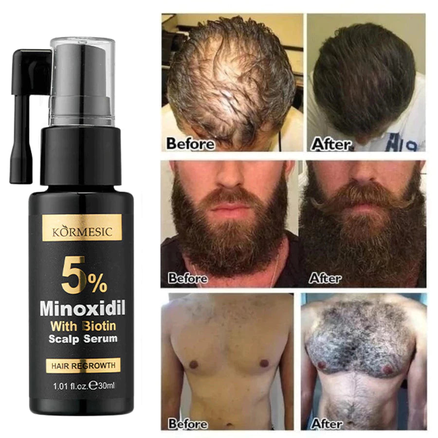 KORMESIC Minoxidil 5% with Biotin Scalp Serum 30ml