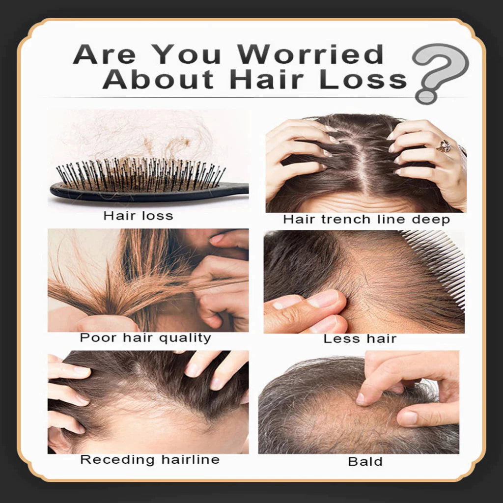 HOSOKU 15% Minoxidil Hair Growth Serum (Oil Based)
