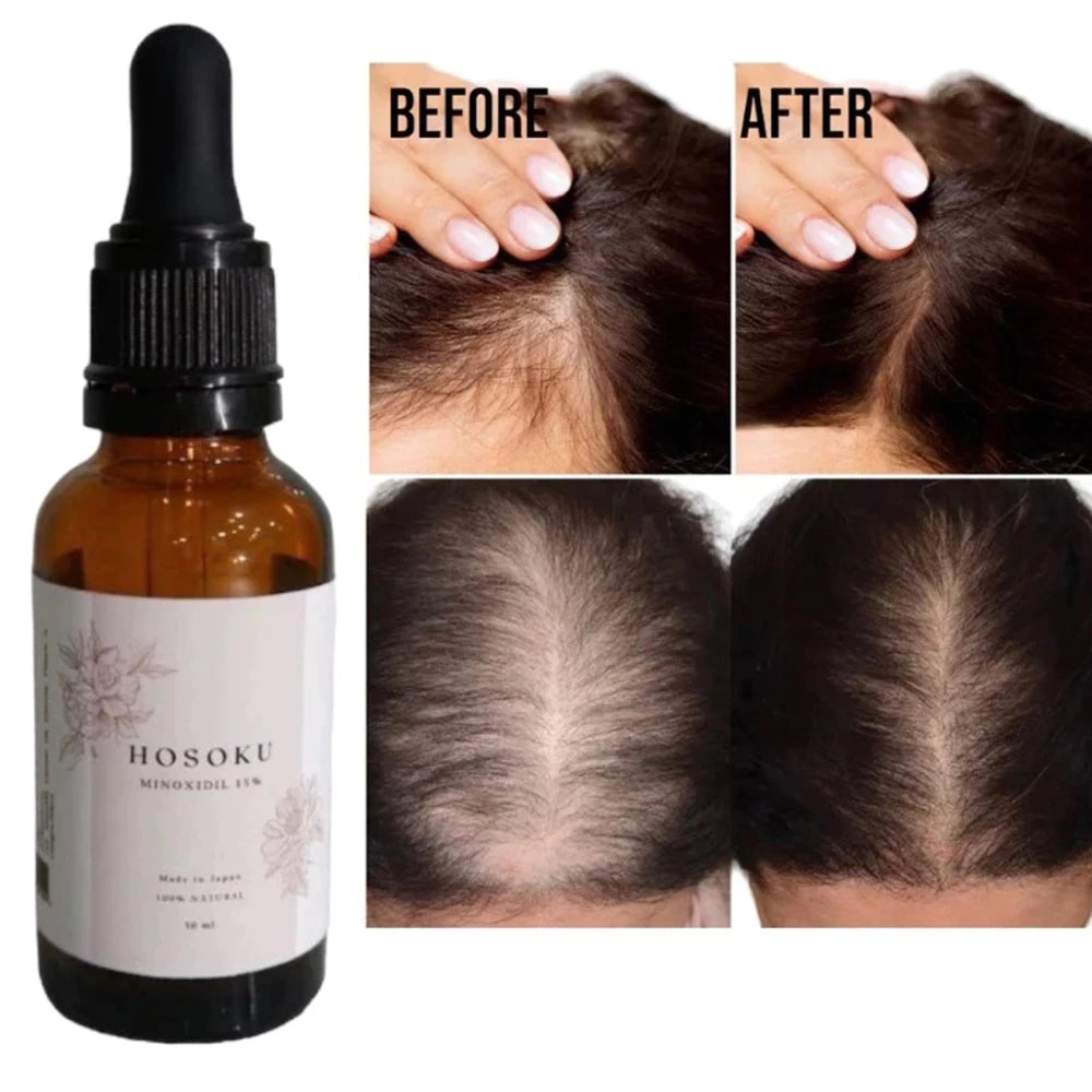 HOSOKU 15% Minoxidil Hair Growth Serum (Oil Based)