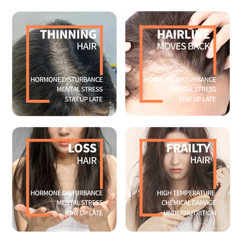 HOSOKU 15% Minoxidil Hair Growth Serum (Oil Based)