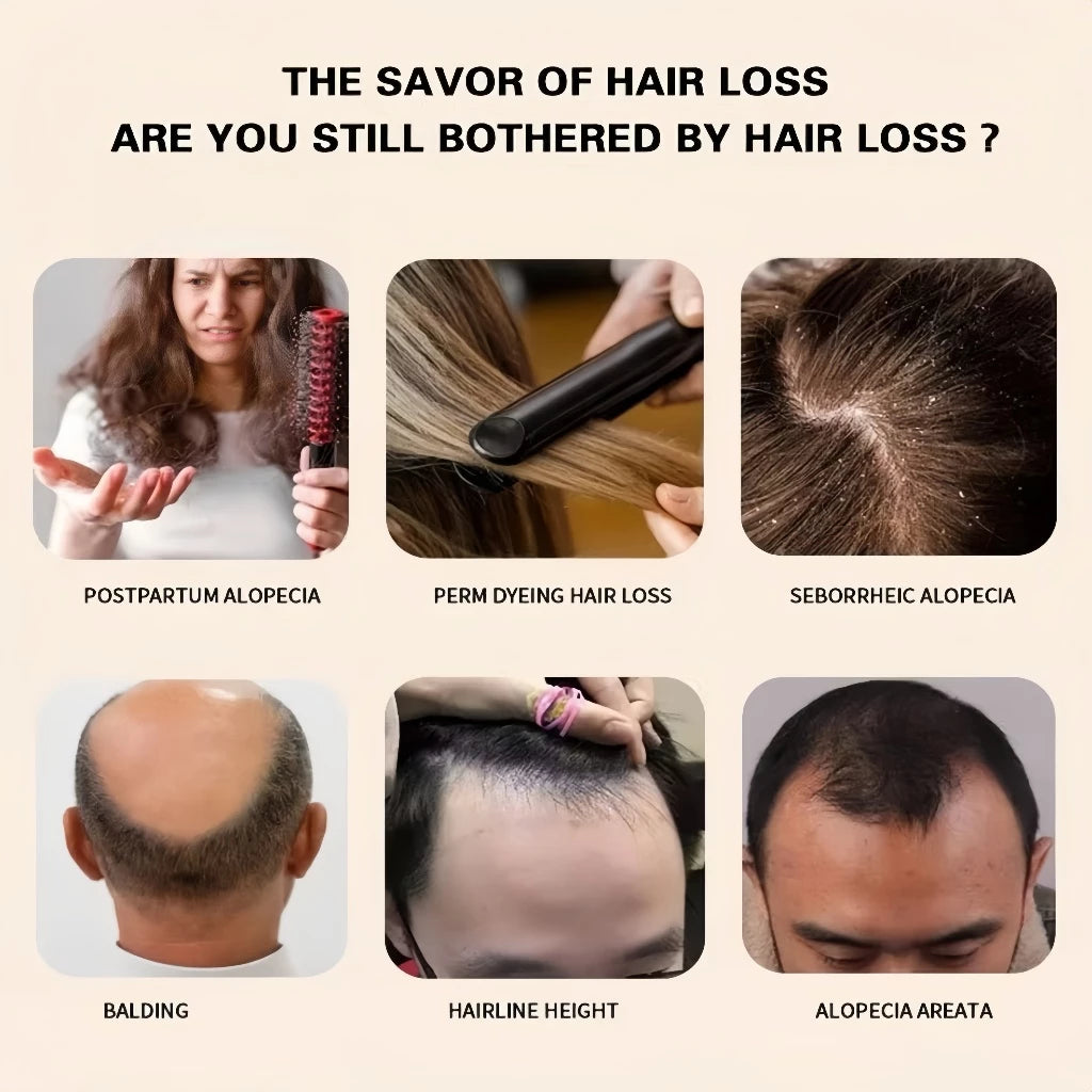 KORMESIC Minoxidil 5% with Biotin Scalp Serum 30ml