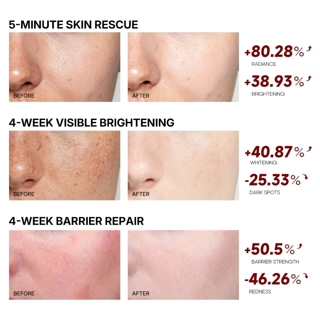 TEASHELL Niacinamide Brightening Skin Essence Cream Pro-Vitamin B5