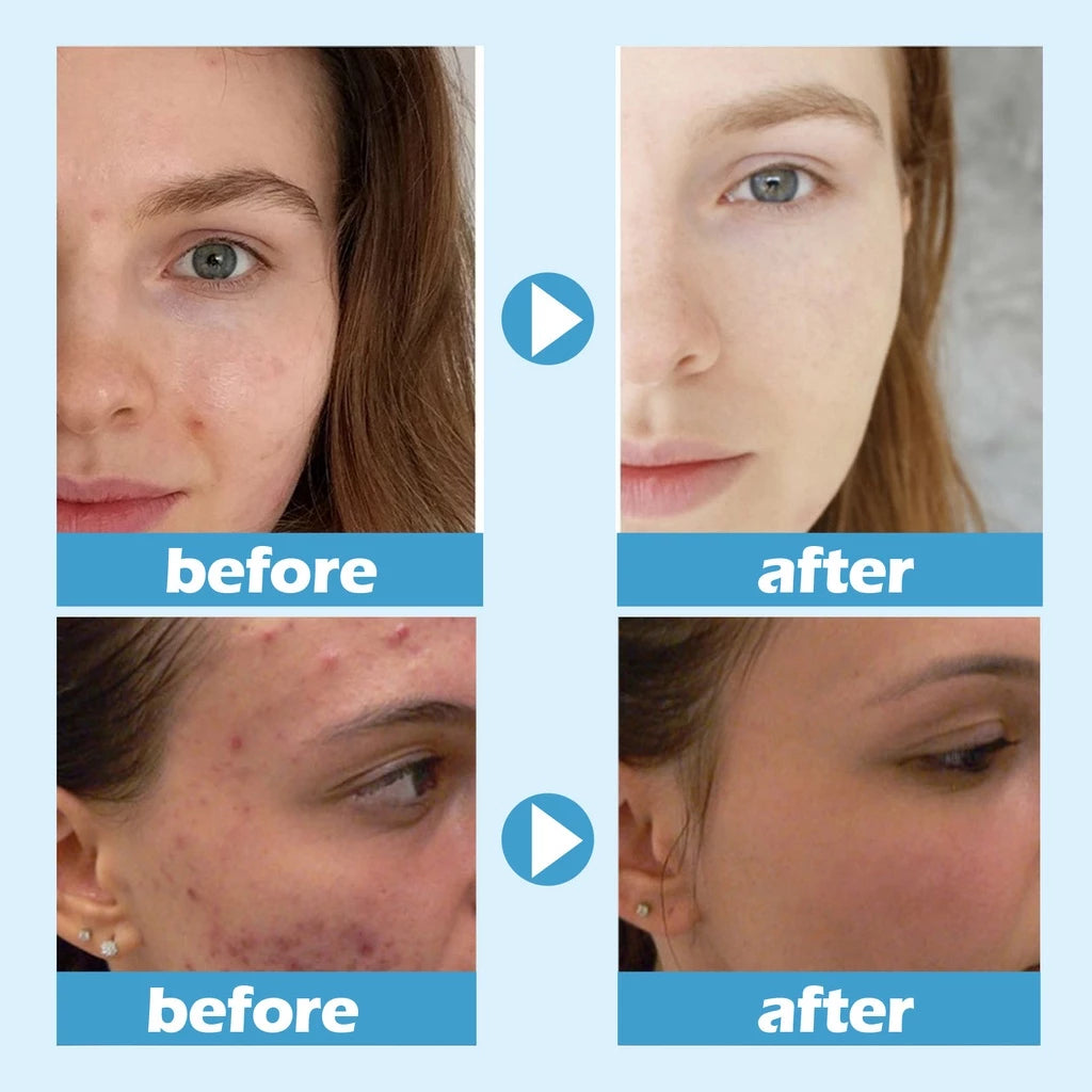 West&Month Hydra Moist Ice Water Sleeping Mask