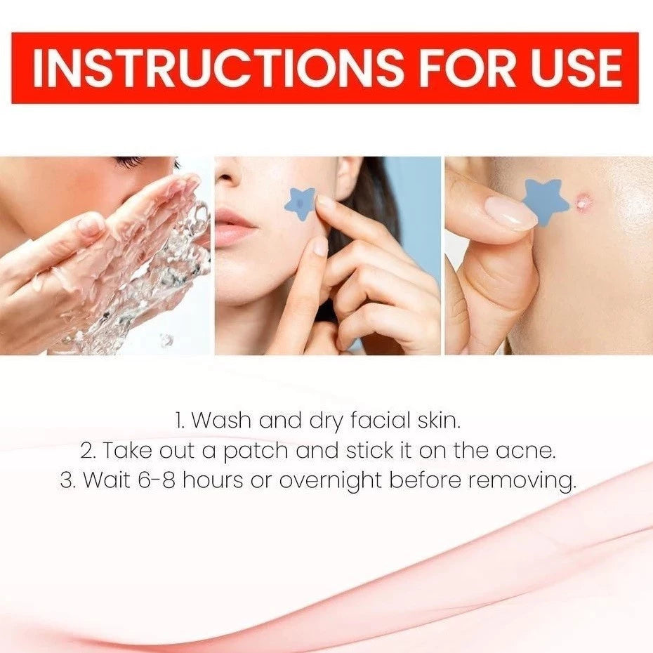 Star Pimple Patch