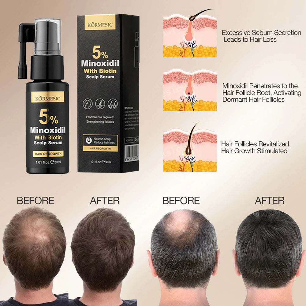 KORMESIC Minoxidil 5% with Biotin Scalp Serum 30ml