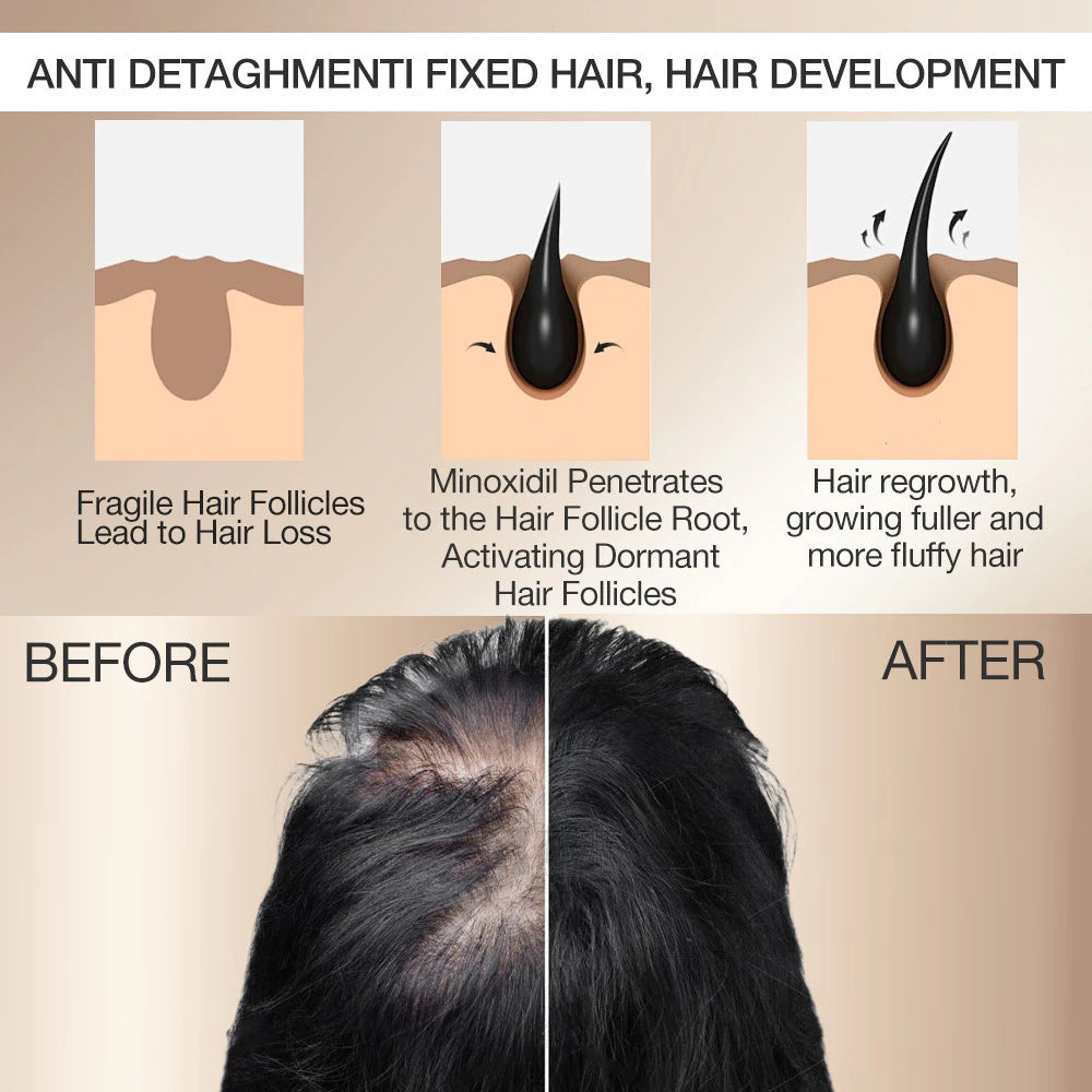 KORMESIC Minoxidil 5% with Biotin Scalp Serum 30ml