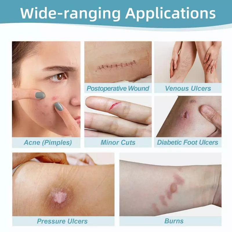 Hydrocolloid Patch Bandages Roll – For Acne, Pimples & Scar Care